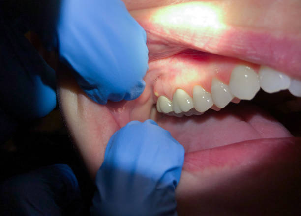 Best Emergency Gum Pain Relief  in New Baltimore, MI