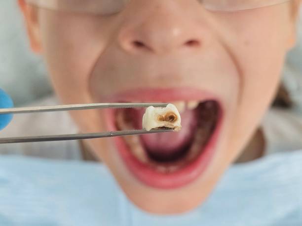 Best Teeth Whitening  in New Baltimore, MI